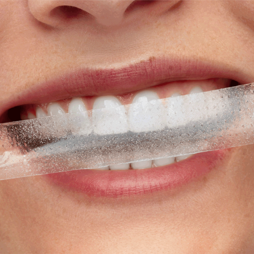 Bild: Smilepen Whitening Strips 