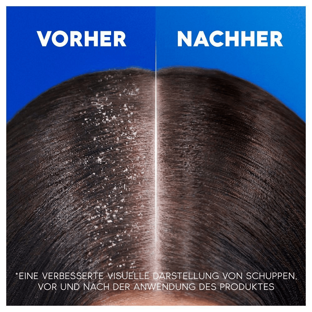 Bild: head & shoulders Anti-Haarverlust Anti-Schuppen Shampoo 