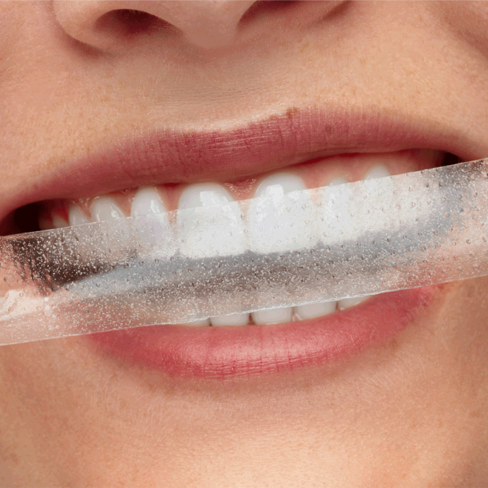 Bild: Smilepen Power Whitening Strips Kit 